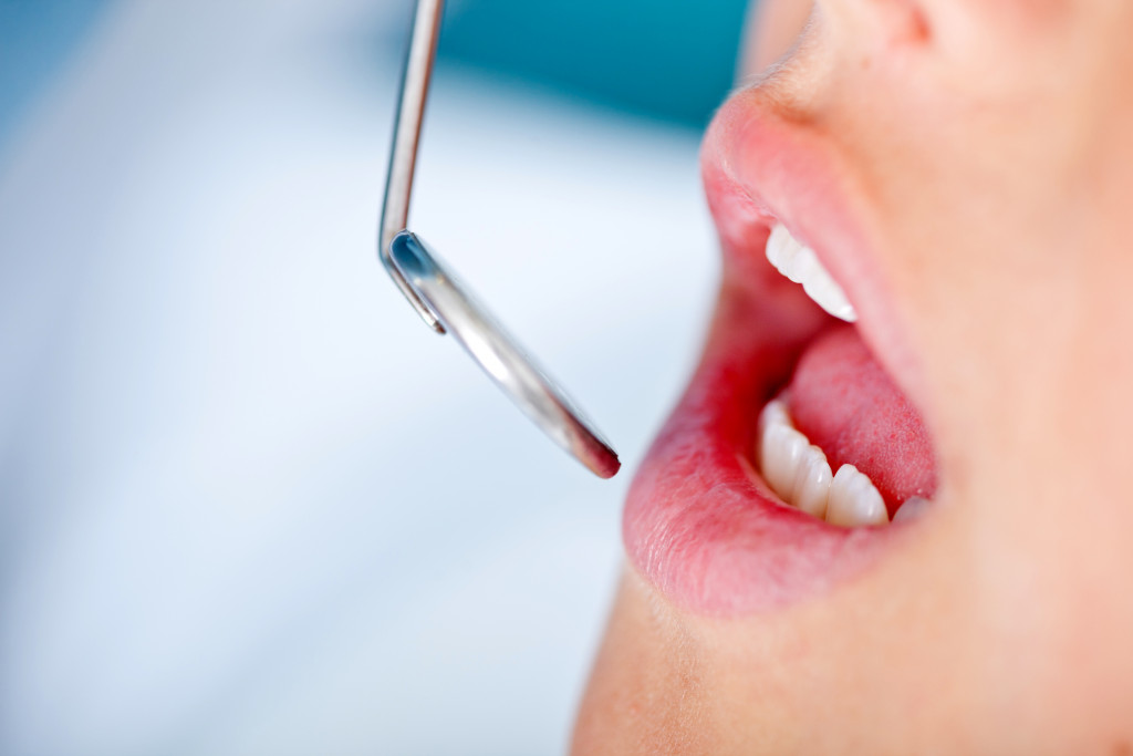 Close up image of a patient's mouth while in a dentist's visit