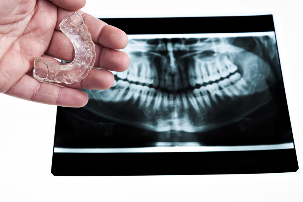bite solution for bruxism with xray